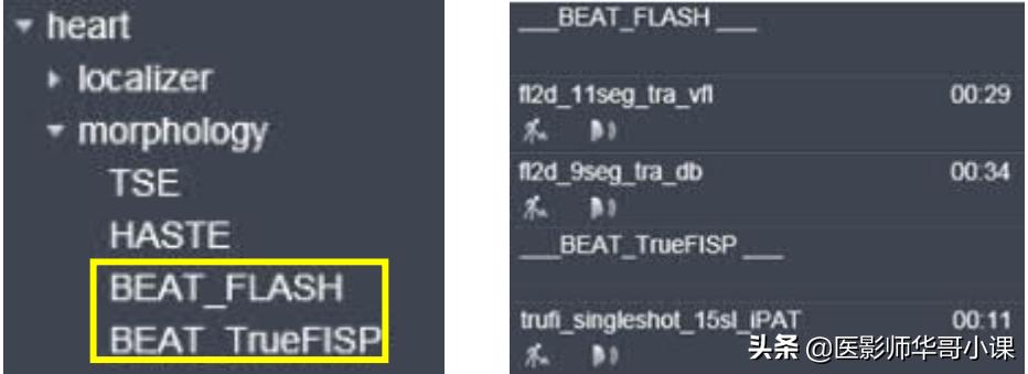 心脏mr增强扫描讲解,磁共振心脏扫描标准切面