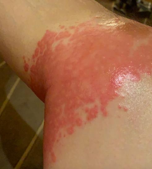 国奥庸医害人！江苏门将半月板撕裂，大夫竟开出治疗遗精的药