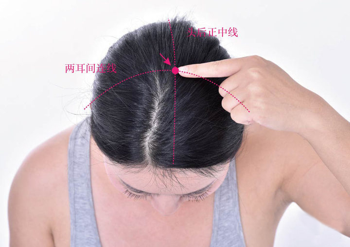 一发热就吃感冒药，分清外感和内伤发热了没？5个穴位清热有特效