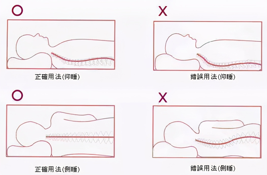 盐焗治腰痛,炒盐热敷腰的正确方法