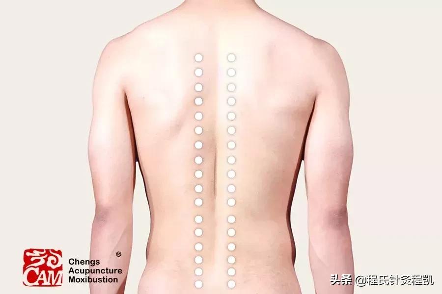 中医治疗顽固性呃逆,顽固性呃逆中药医案