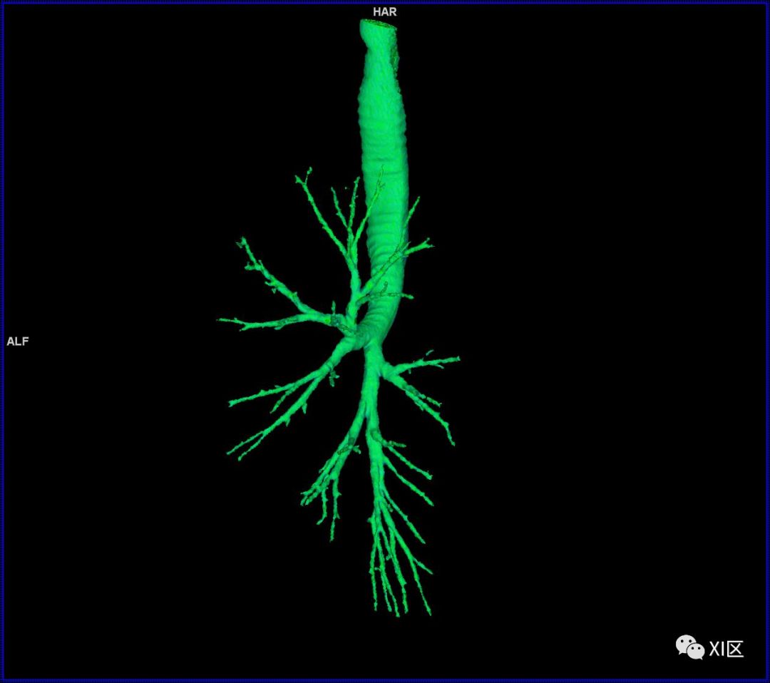 如此详细的肺部影像解剖，有点儿酷