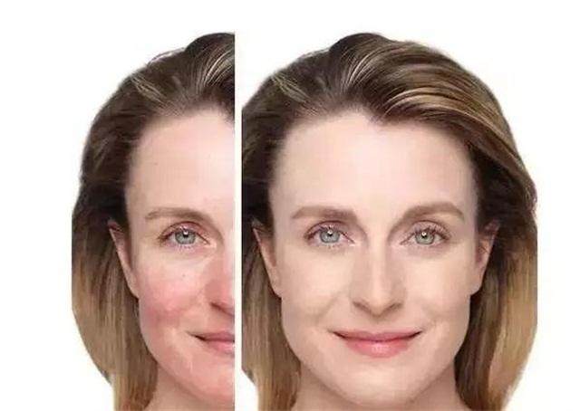 春季换季过敏怎么办,春季换季过敏