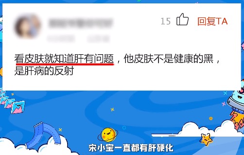 宋小宝爆改白发,宋小宝新戏头发花白