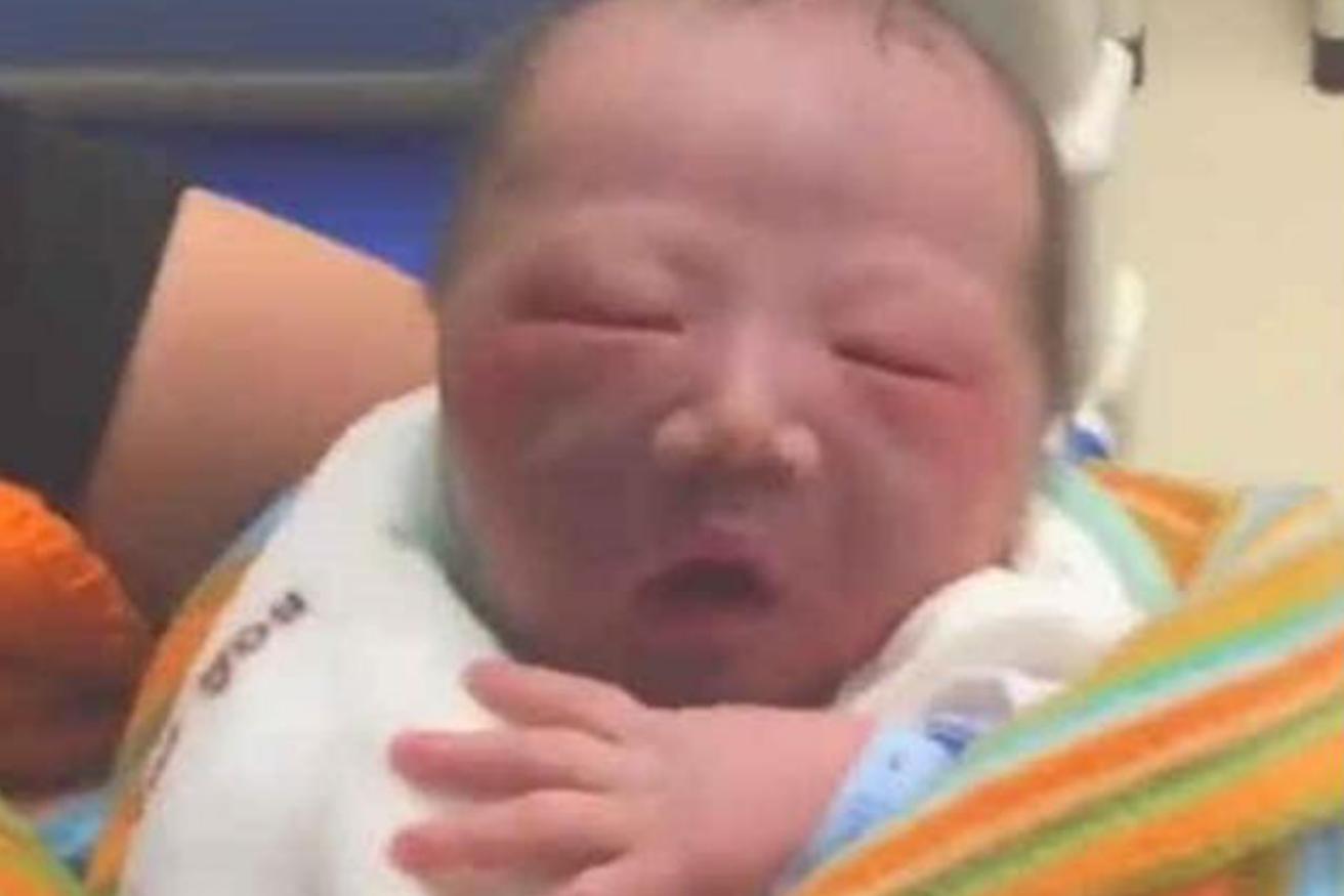 孕期看丑宝宝,刚生出的丑宝宝