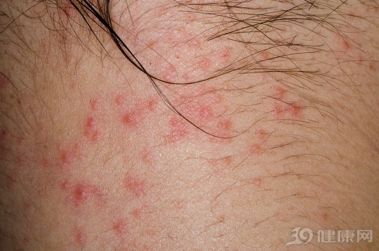 每天一杯菊花枸杞茶有什么好处,每天一杯菊花茶会带来什么好处