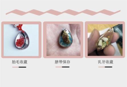 新生儿脐带脱落后需要怎么处理,新生儿脐带脱落后如何处理