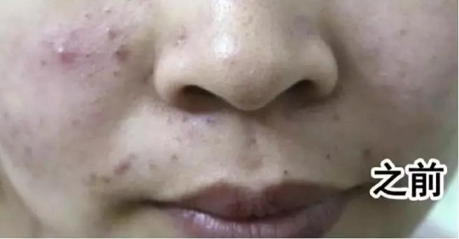 头油头皮屑多脱发洗发水,头油头皮屑多洗发水推荐