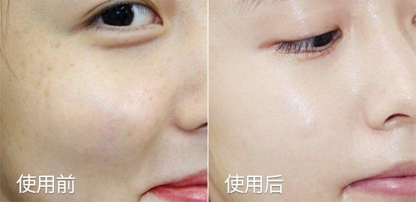 琚佸濮楁帹鑽愯憽钀勭苯鎶よ偆,琚佸濮楄憽钀勭苯绮惧崕