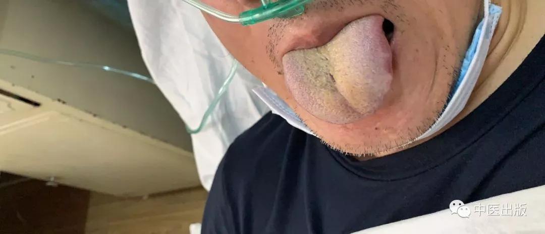 家里消毒用什么方法最好,医生建议家里用什么消毒