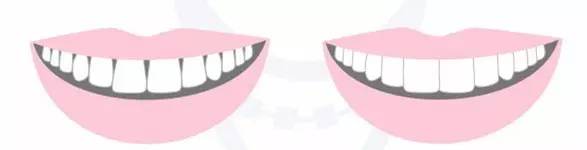 黑三角到底是什么,为什么黑三角越来越多