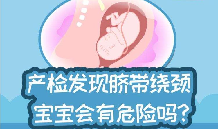 孕期胎儿绕颈？你必须知道这些