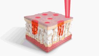 痘印痘坑真正祛除的方法,痘印痘坑去不掉怎么办