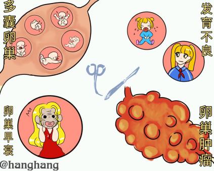 不孕不育漫画解说,不孕不育漫画