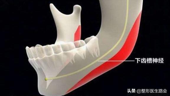 蘑菇怎么变成鹅蛋脸,国字脸磨骨成瓜子脸多少钱