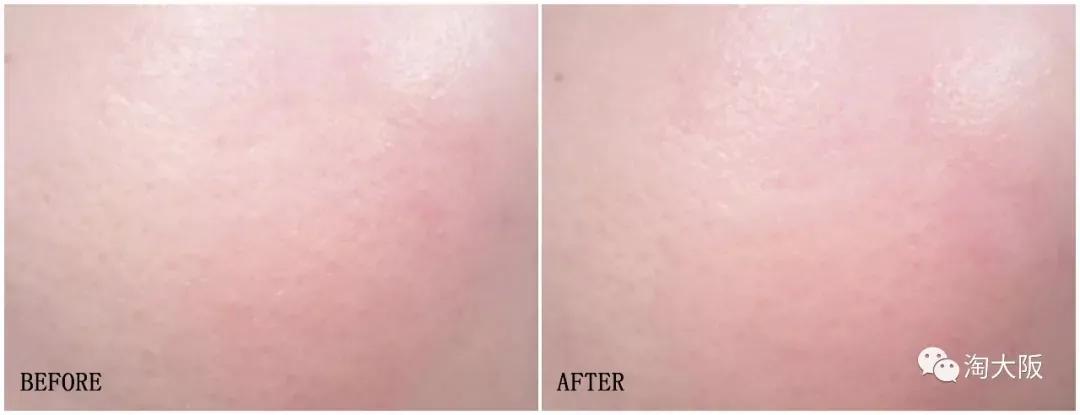 黛珂璀璨花火款,黛珂顶级精华