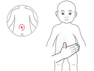 宝宝积食不用消食片怎么调理,积食高烧39度退烧小妙招推拿手法