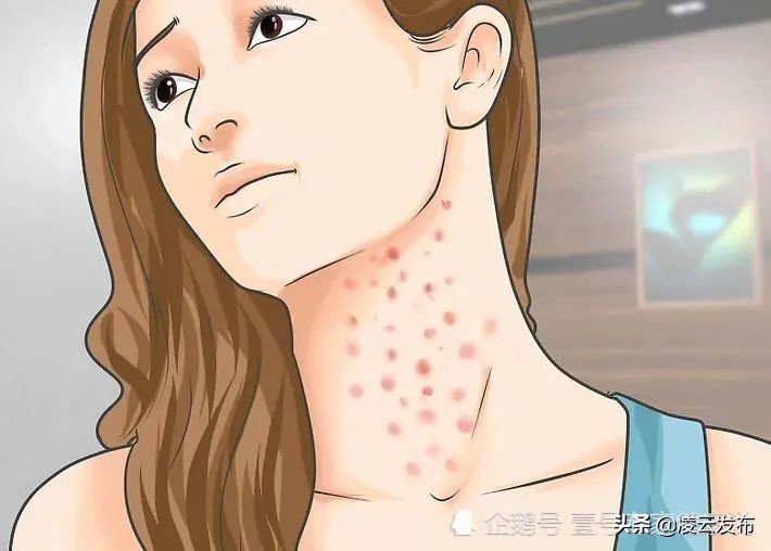 女性感染艾滋病都有哪些反应,女人感染艾滋病会有什么症状