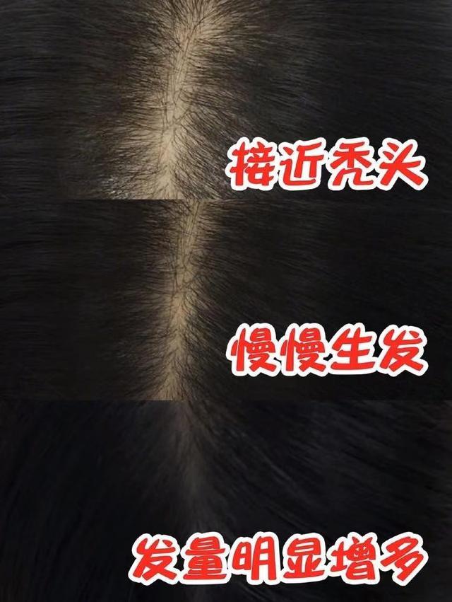 平价洗发水推荐男士去屑控油,价格平民又比较好用的洗发水推荐