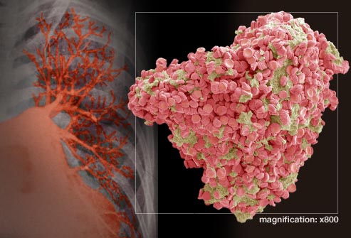 坐飞机太久会有什么综合症,坐飞机没休息对身体有什么影响