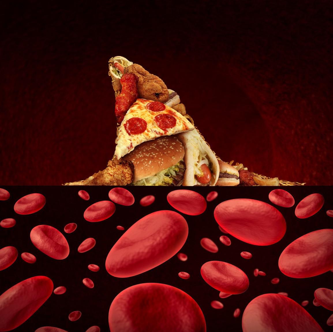 血脂正常还需要用调脂药吗,血脂高献血浆能降低血脂吗