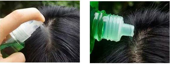 雄性激素脱发怎么自救,自救脱发最有效的方法