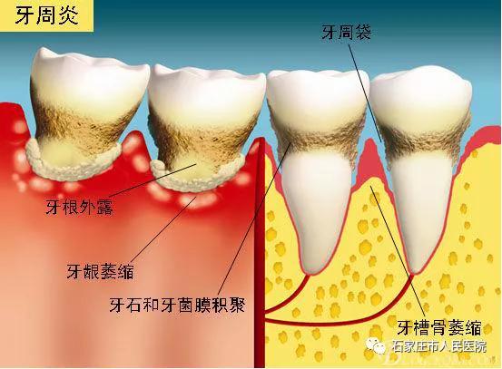 告诉你个秘密，“无齿”的原因是……