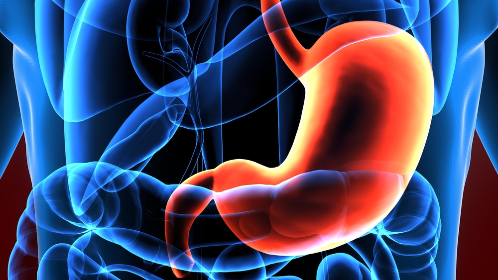 食道息肉和胃息肉切除是一样的吗,胃息肉癌变后切除会引起胃癌吗