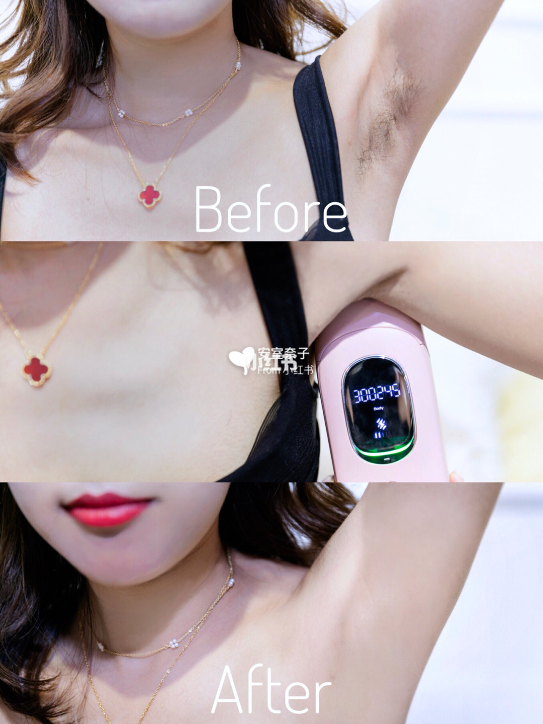 小红书二手脱毛仪靠谱吗,各大美妆博主脱毛仪