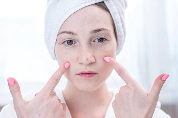 挤压抓挠后，鼻子两侧总能出现白色条状物，它是粉刺和黑头？