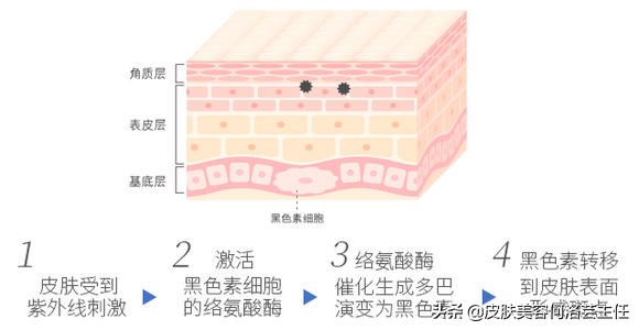 脸上有色斑应该怎么调理,脸上斑越来越多原因及治疗方法