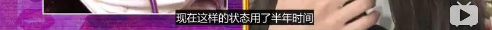 那些整容脸真的觉得自己好看吗,为什么整容以后都是一样的网红脸