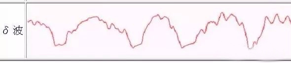 脑波成像,脑波疗法