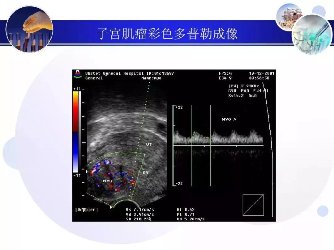 纯干货！子宫及附件解剖和超声诊断