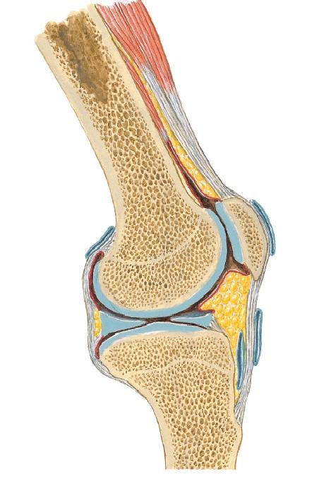 膝盖半月板损伤三年了还能自愈吗,内侧半月板后角损伤2-3级能自愈