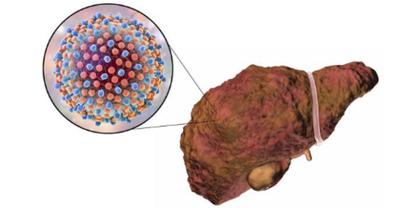 鍚冮敊鑽コ瀛╄倽琛扮,鍚冮敊鑽コ瀛╄倽琛扮鐜扮姸