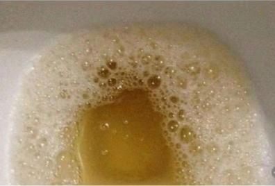 宝宝便秘吃益生菌后大便次数多,小孩便秘大便干用什么益生菌好