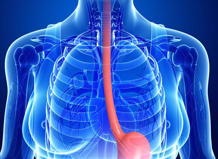 肺鳞癌放疗引起的气管食管瘘,食管鳞状细胞癌放疗并发症