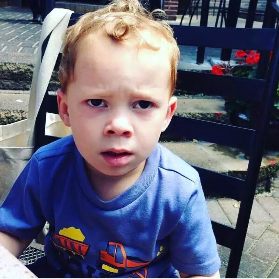 嘴上长了一个巨大的口腔溃疡,嘴皮上长了个口腔溃疡