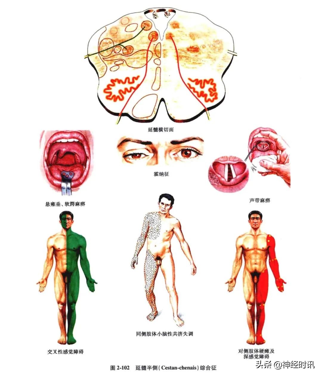 脑干解剖,脑干神经解剖