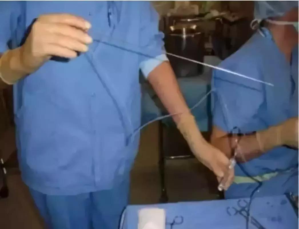 揭露代孕的骗局,揭露代孕黑色产业链的案例