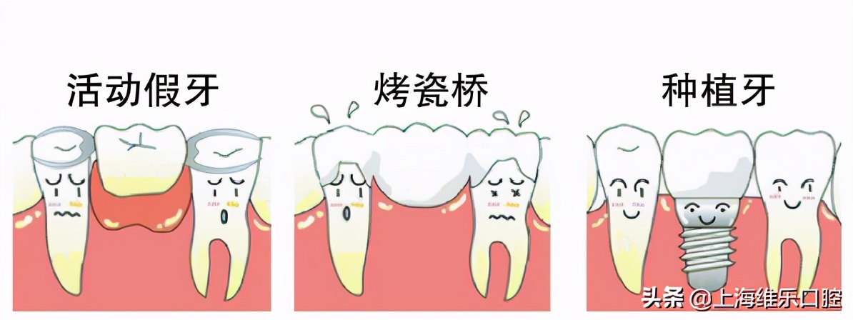 戴假牙导致牙龈增生,戴假牙牙龈肿痛怎么缓解