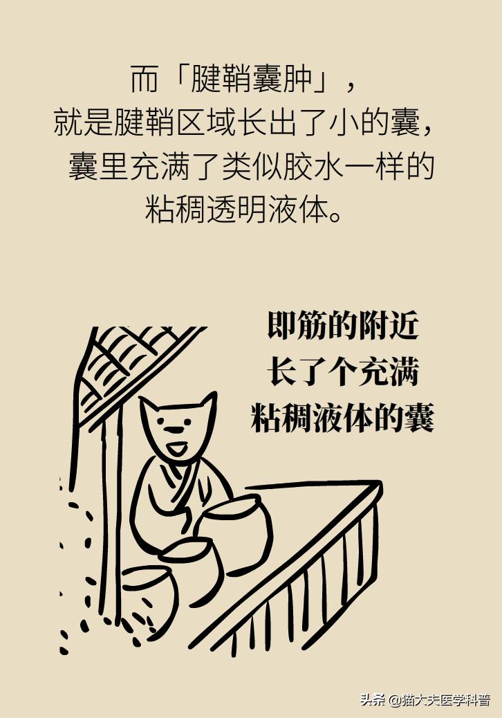手腕长腱鞘囊肿,手腕上有个凸起的包腱鞘囊肿