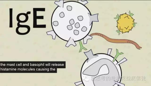 易跟湿疹混淆的罕见病：高IgE综合征什么样疾病？