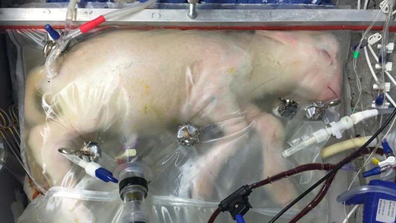 生孩子不再需要女人？人造子宫或将到来，对女人是好事还是危机？