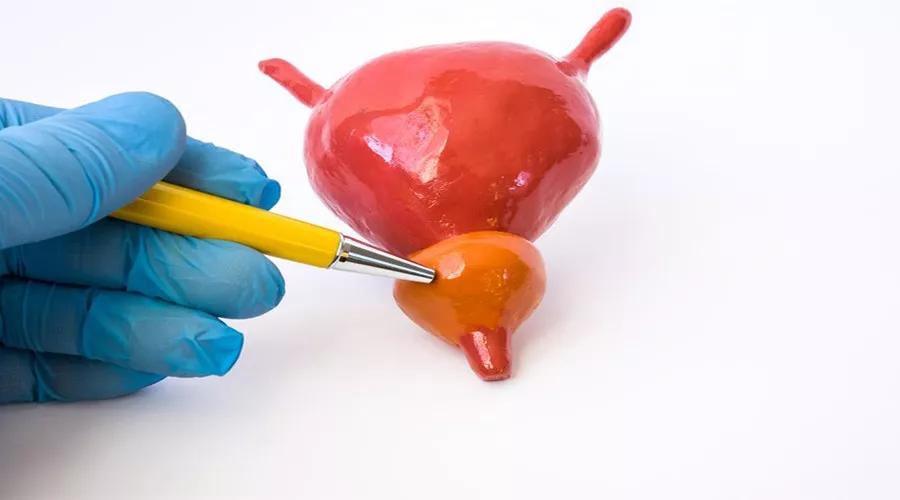 男孩尿液混浊的原因,吃鱼后尿液混浊是什么原因