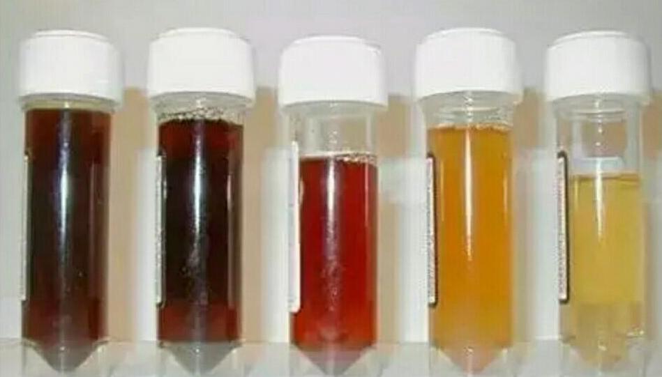 宝宝尿液出现2种颜色，或是身体发出的“健康信号”，父母要重视