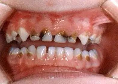 宝宝嘴里有白色的小点叫什么,一个月宝宝口腔上颚白色的是什么