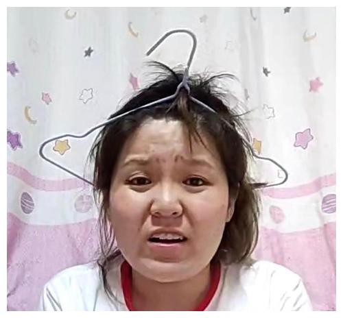 哪个明星做了颧骨内推,颧骨内推明星前后对比