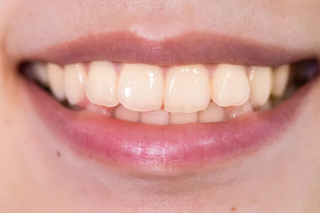 除牙结石美白防口臭的牙膏测评,马卡龙牙膏刷的干净吗